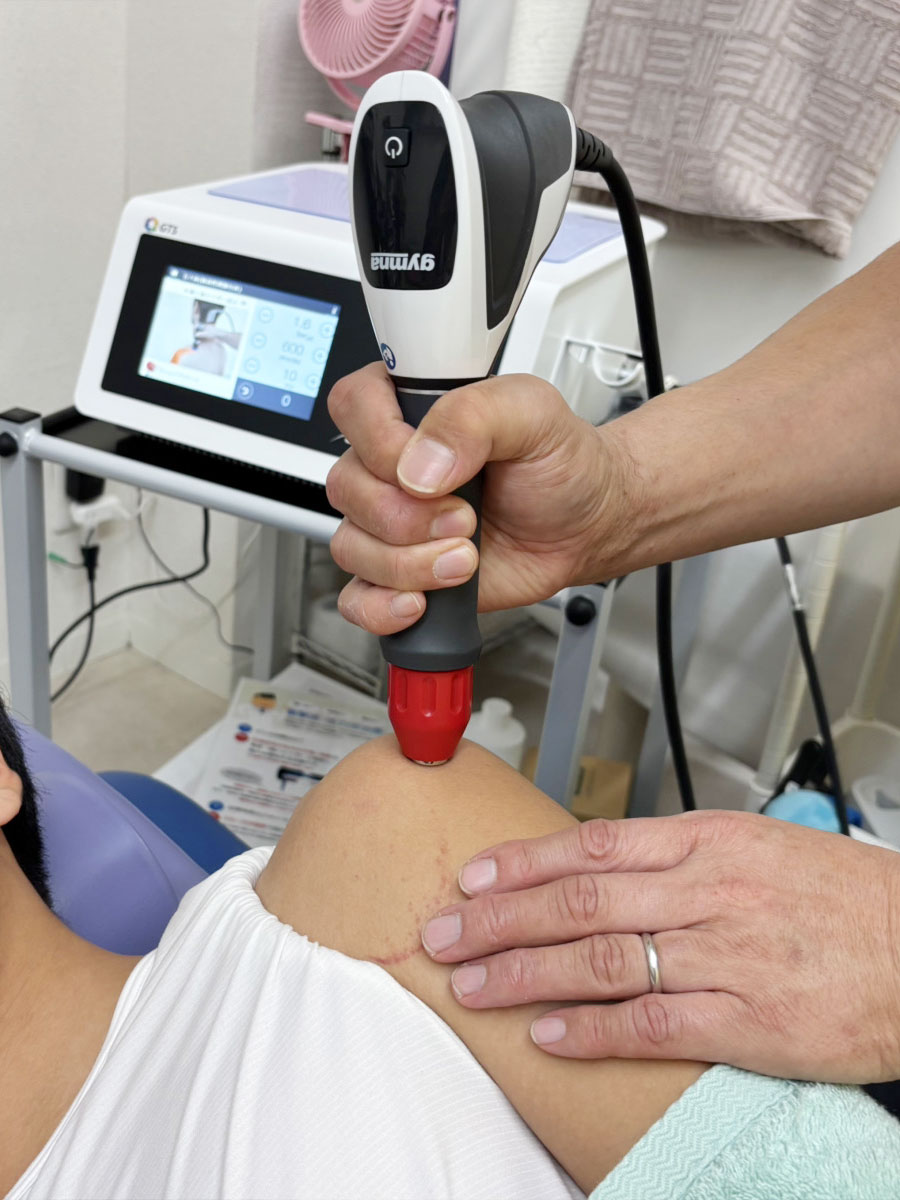 shockwave-therapy_img02_