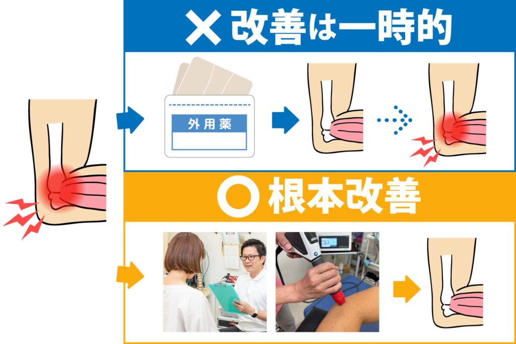 hanaike-tennis-elbow_img04