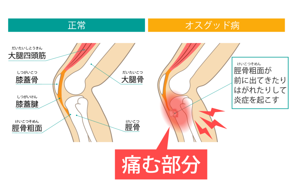 hanaike-osgood_img02