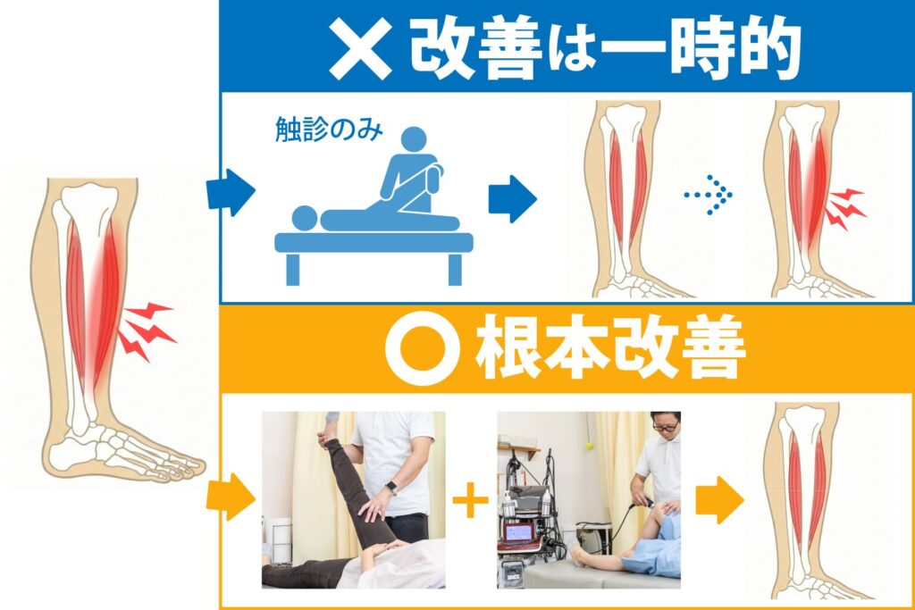 hanaike-shin-splints_img04