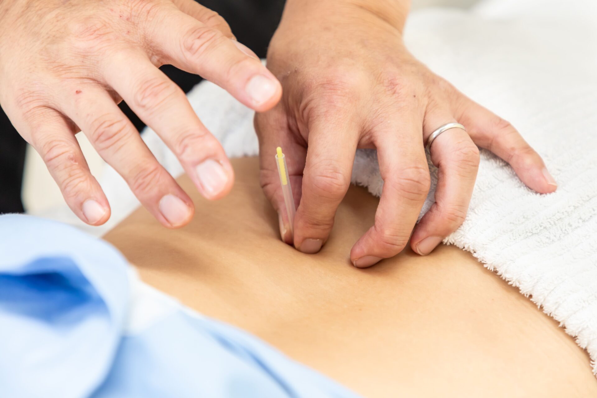 hanaike_acupuncture-and-massage_img01