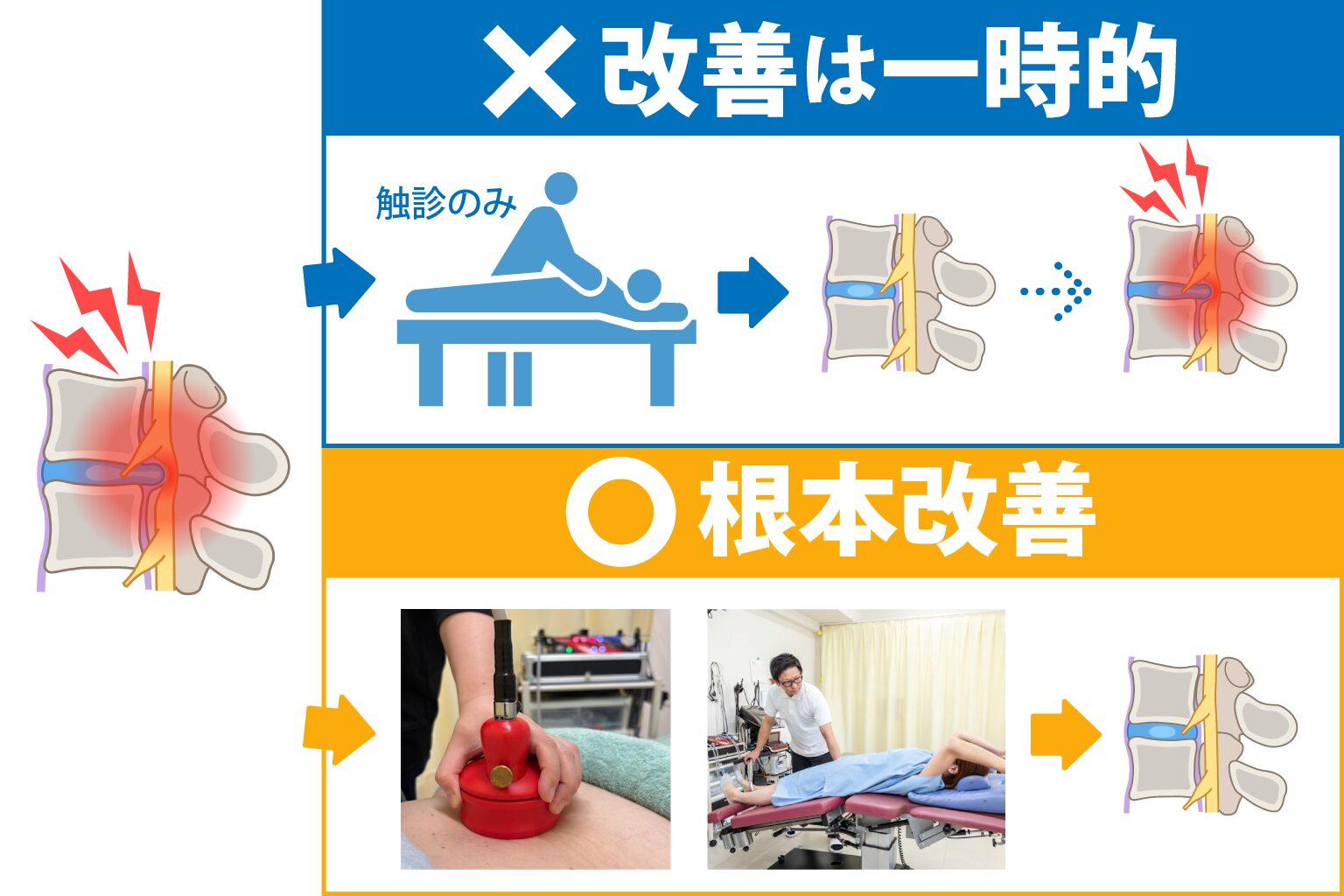 hanaike-hernia_img